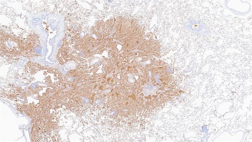 Feature-stain-BOND-PRIME-Napsin-A-Lung